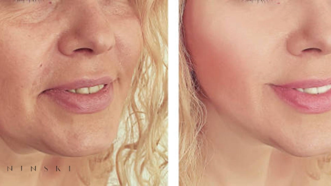 Transform Your Beauty Journey with HIFU Treatments at Ninski London