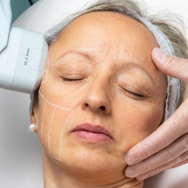 Benefits of HIFU: Unlock Radiant Skin with Cutting-Edge Tech