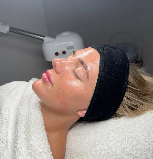 The Magic of Glycolic Skin Peels in Crystal Palace