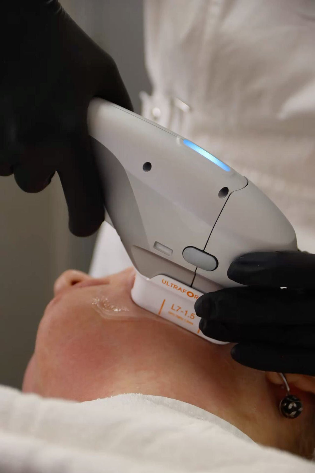 Benefits of HIFU: Unlock Radiant Skin with Cutting-Edge Tech