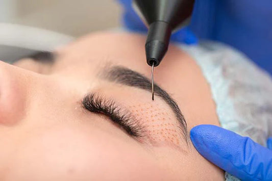Plasma Pen Fibroblast Training (1 day course)