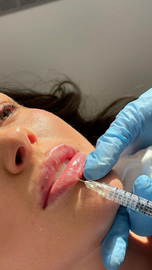Advanced Dermal Filler Masterclass (2 day course)
